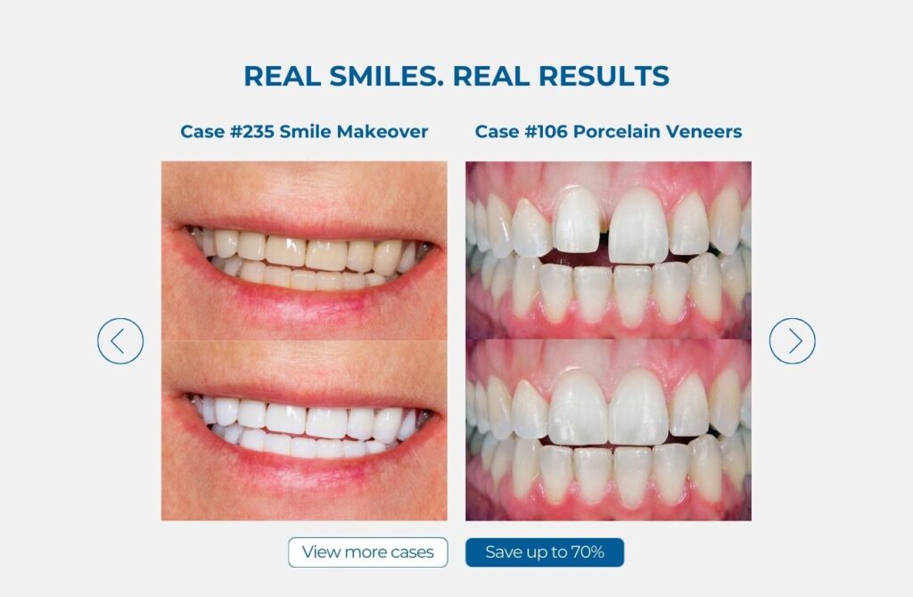 Marketing digital para clínica dental en Tijuana