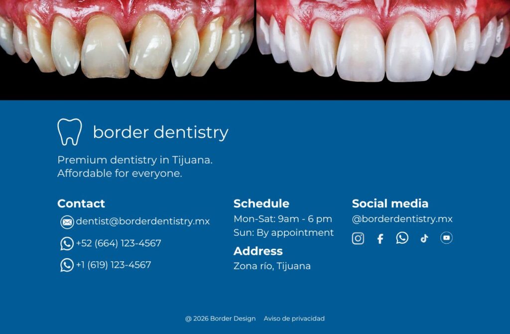 Marketing digital para clínica dental en Tijuana
